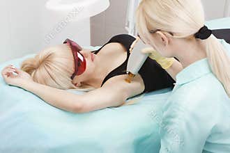 Laser hair removal