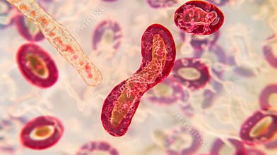 A microscopic view of a smear showing a of sickleshaped red cells a clear indication of sickle cell anemia. .