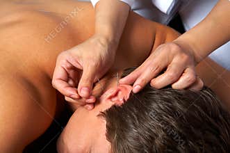 Acupuncture of ear