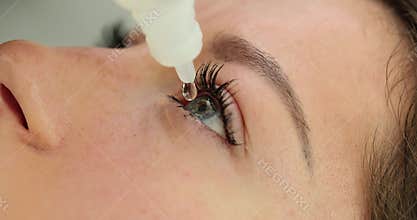 Woman puts eye drops into eye
