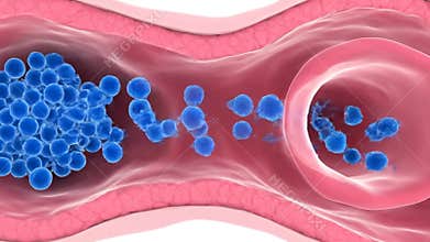 Blue Blood Cell Aggregation Animation Inside Pink Artery Walls Medical Illustration Animated Blood Clot Formation And