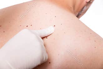 Screening the skin of a man