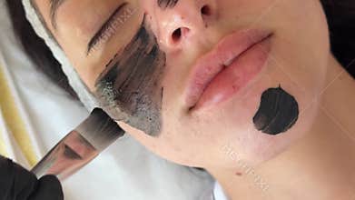 Young woman getting carbon laser facial at beauty clinic. Professional skincare