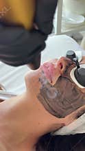 Young woman getting carbon laser facial at beauty clinic. Professional skincare