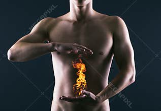 Heartburn.