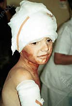 BOSNIAN CIVIL WAR