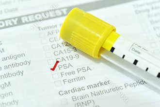 Blood sample tube for PSA test