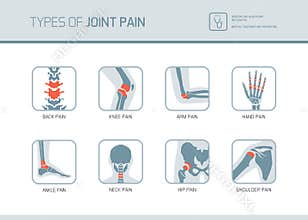 Types of joint pain