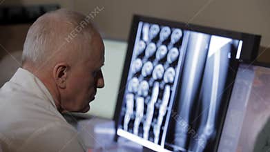 Doctor analyzing x-ray.