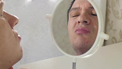 Man with pimples in a front of mirror