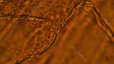 Garlic cells under microscope.