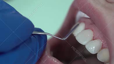 Dentist puts dental veneers patient and correction of teeth