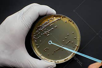 close up scientist pick-up single colony of bacteria with disposable loop