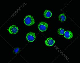 Leukemic Cells