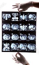 Examining MRT Film.