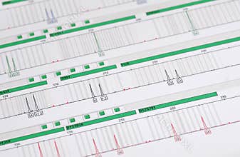 DNA Profile - Genetic Fingerprint