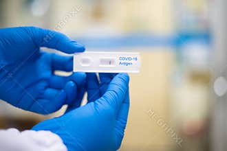 Screening rapid test COVID-19 antigen negative