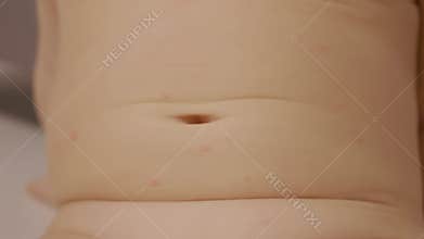 Child with early signs of chickenpox on belly in warm indoor setting