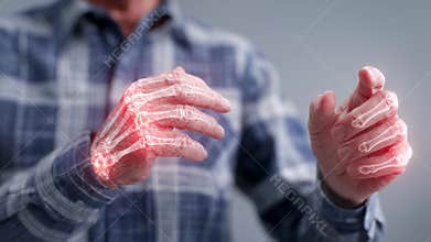 Elderly man showing osteoarthritis symptoms in hands