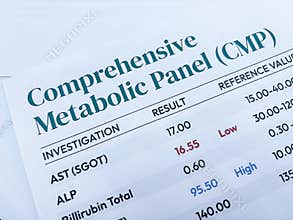 Close up of a Comprehensive Metabolic Panel CMP medical report showing laboratory results for AST ALP and Bilirubin