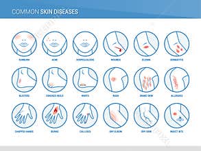 Common skin diseases