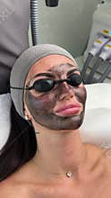 Young woman getting carbon laser facial at beauty clinic. Professional skincare