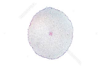 Dicot root cross section slide view under microscope for botany education