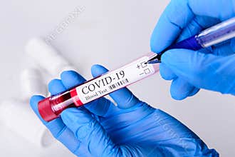 Covid-19 coronavirus disease blood test tube in hands epidemic concept background