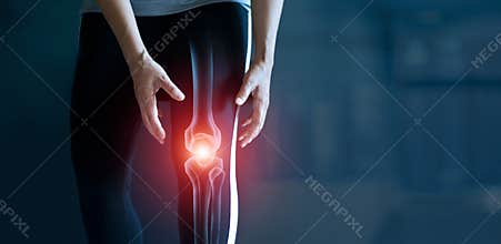 Woman suffering from pain in knee, Injury from workout and osteoarthritis, Tendon problems and Joint inflammation on dark