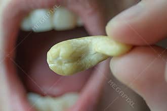 Cashew nuts. he cashew tree is a tropical evergreen tree that produces the cashew seed and the cashew apple.