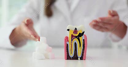 Sugar destroys tooth enamel and leads to dental caries