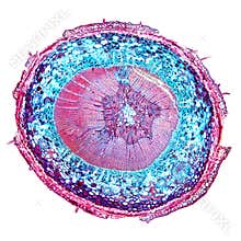 Pine tree stem, Pinus, cross section, 20X light micrograph
