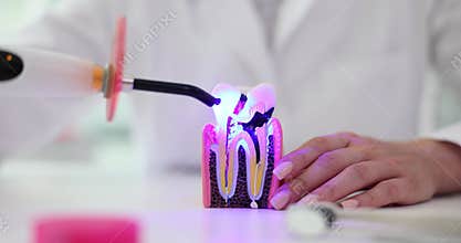 Photopolymer lamp Doctor with a glowing blue lamp and tooth with caries