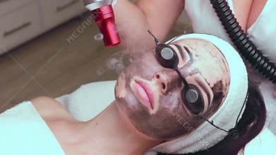 Beautician doing hardware carbon peeling to a young beautiful client in a