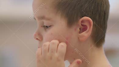 A young child suffering from a skin condition chickenpox, showcasing their unique journey and resilience