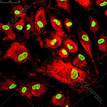 Mesenchymal stem cells