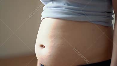 Stomach Skin Showing Red Rash in a medical Close Up