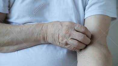 Man with itchy arm
