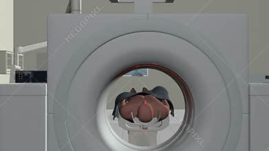 MRI Scan, Camera Fly from Brain Scan, stock footage