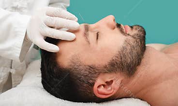Acupuncture treatment for man headache and migraine. Certified acupuncturist treats a man\'s migraines with needles