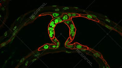 Lymphatic Valve Leaflet Architecture Confocal Fluorescence