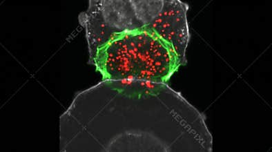NK Cell Cytotoxic Granule Polarization Lytic Synapse