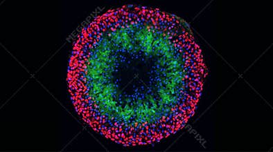 Tumor Spheroid Hypoxia Core Necrosis Structure