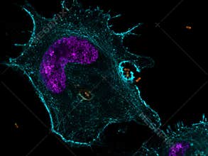 Human macrophage phagocytosing bacteria, confocal immunofluorescence visualization