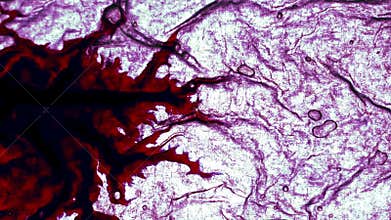 Disease Affects the Body