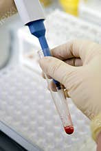 Blood test