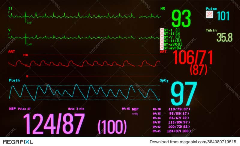 Monitor Atrial Flutter Stock Images by Megapixl