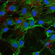 Mesenchymal stem cells