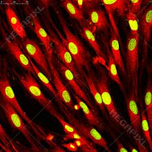Fibroblasts (skin cells) labeled with fluorescent dyes