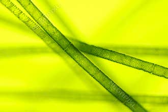 Microscopic view of green algae (Spirogyra)
